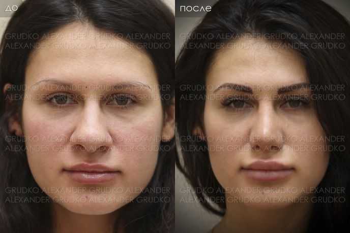 Как уменьшить нос с помощью макияжа - фото и видео инструкция | ринопластика носа