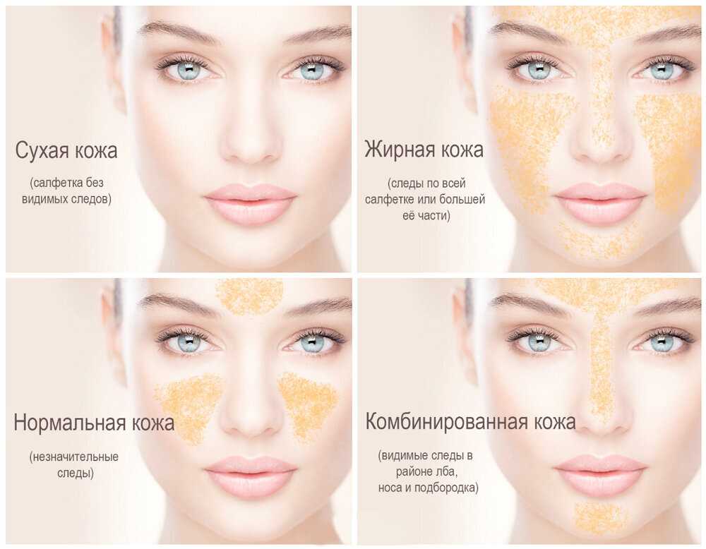Проблемная кожа: как ухаживать за проблемной кожей | vogue russia