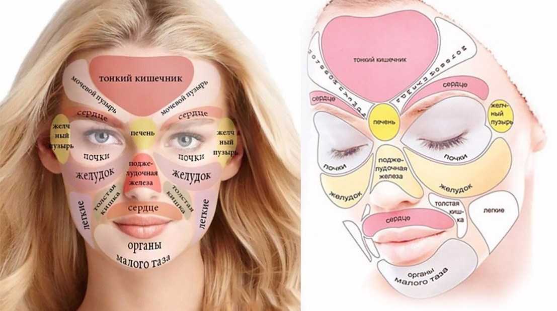 Симптомы и лечение анке (угревая сыпь), лечение угревой сыпи на лице.