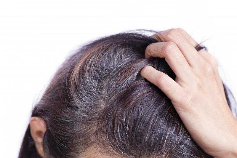 Причины появления седых волос. связь с генетикой и раннее поседение