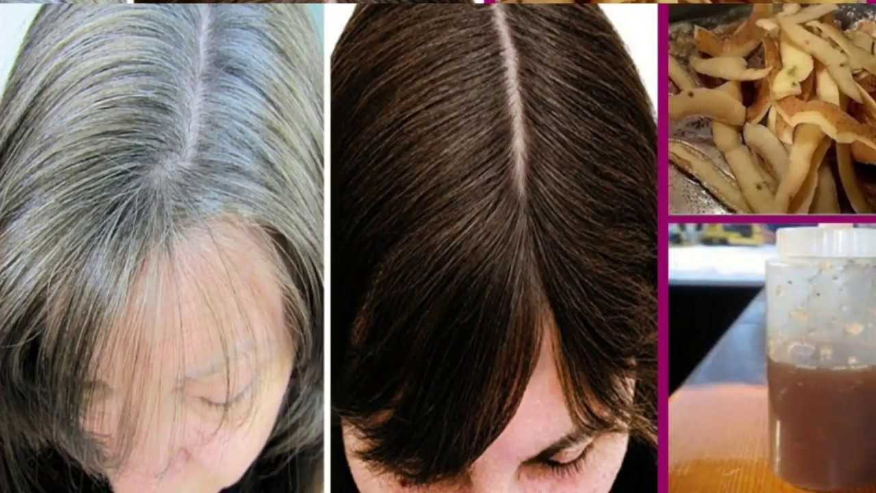 Волосы на лице у женщин