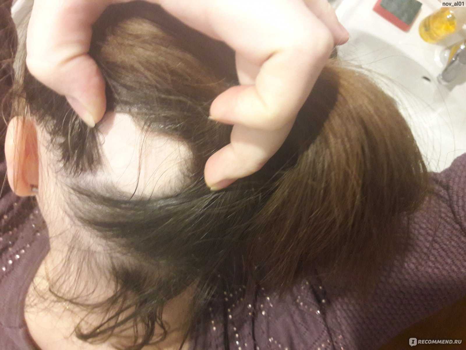 Топ-15 масок против выпадения волос в домашних условиях | poudre.ru