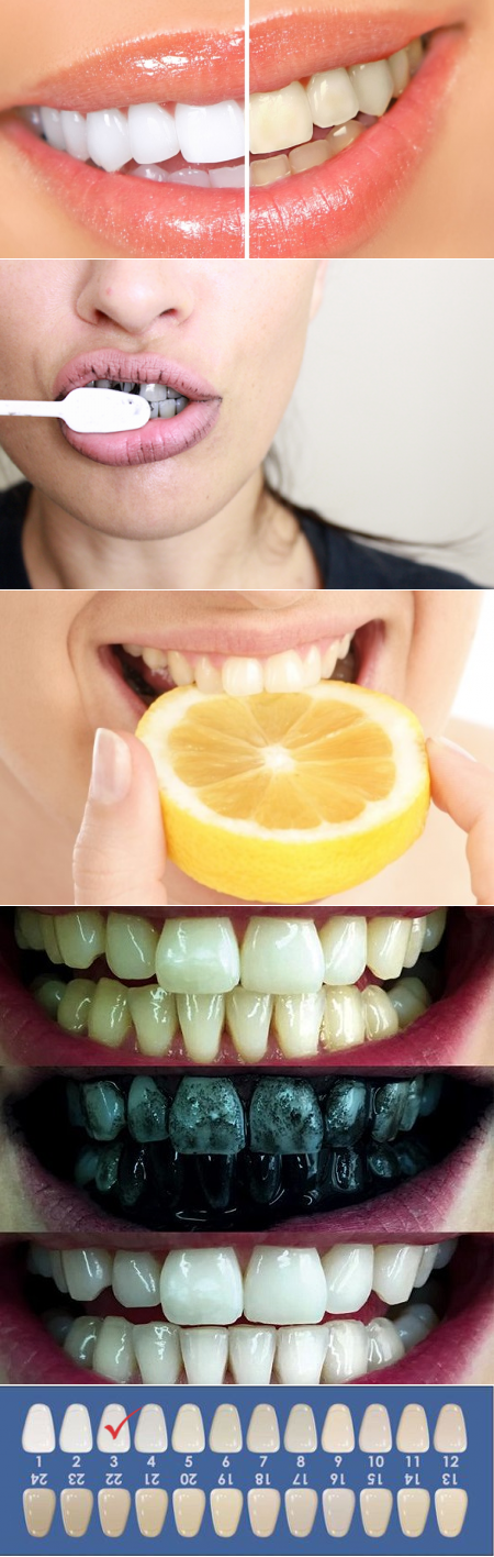 лучшее отбеливание зубов домашних условиях
