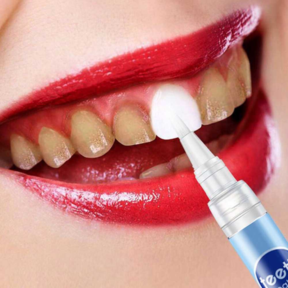 Стоит ли отбеливать зубы? показания и противопоказания к отбеливанию