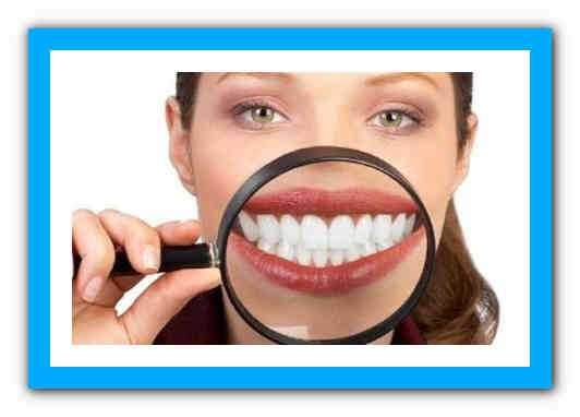 Как отбелить зубы без вреда (быстро и эффективно)?