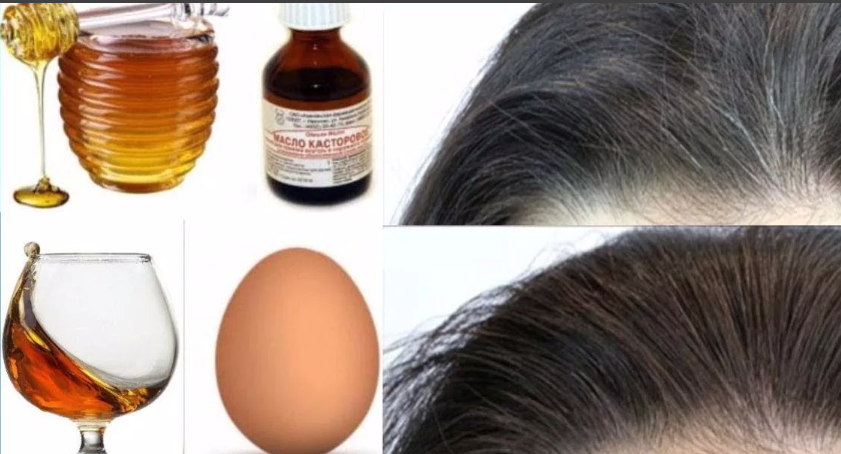 Как удалить волосы на лице и теле - способы удаления волос