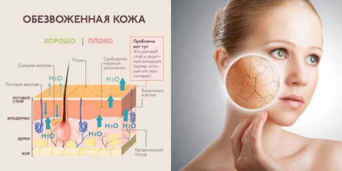 Как отличить сухую кожу от обезвоженной - 5 главных отличий