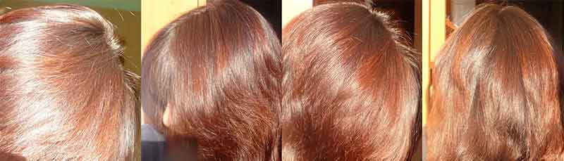 Ополаскивание волос луковой шелухой: как делать и для чего это нужно, можно ли использовать для придания оттенка, а также фото до и после процедуры