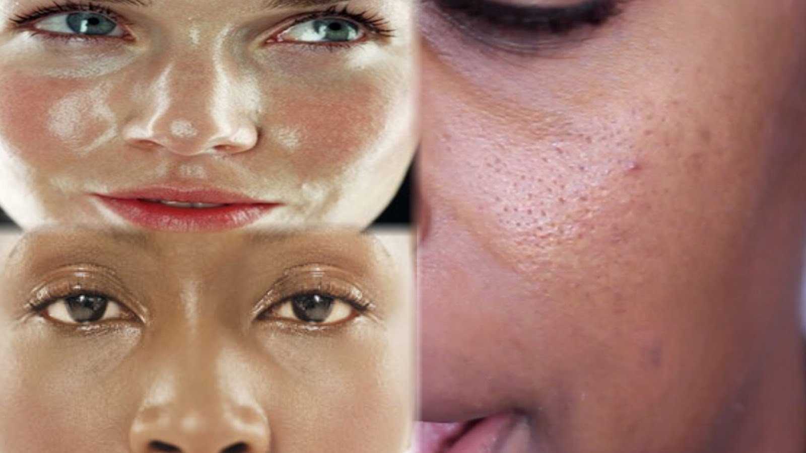 Какие средства нужны для жирной кожи лица: топ лучших косметических, уходовых, очищающих, увлажняющих, народных  и аптечных средств