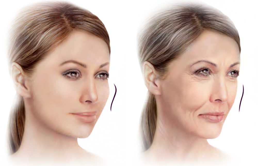 Как сделать скулы на лице при помощи макияжа