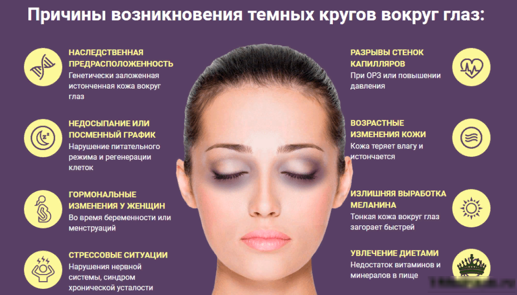 Что вызывает сухость кожи вокруг глаз 15 домашних средств для  сухой кожи вокруг глаз Советы как предотвратить сухость кожи вокруг глаз