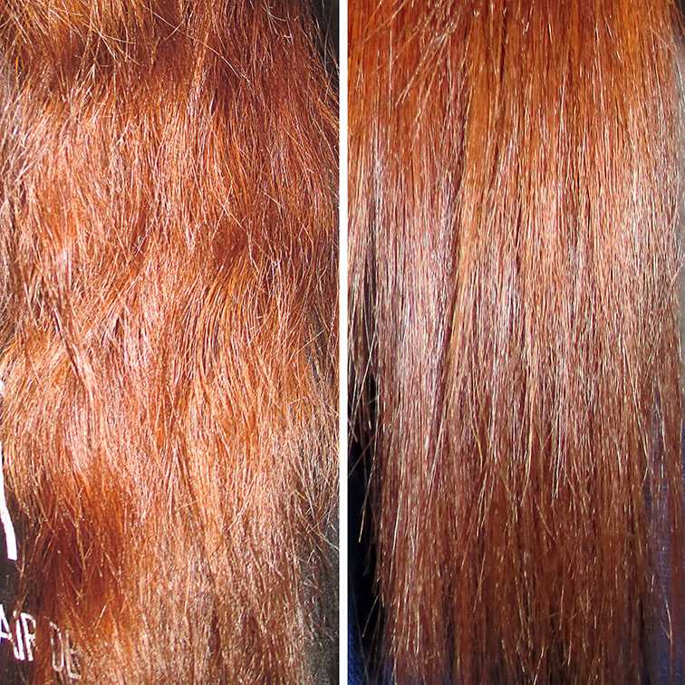 Как избежать выпадения волос: что такое алопеция, почему выпадают волосы