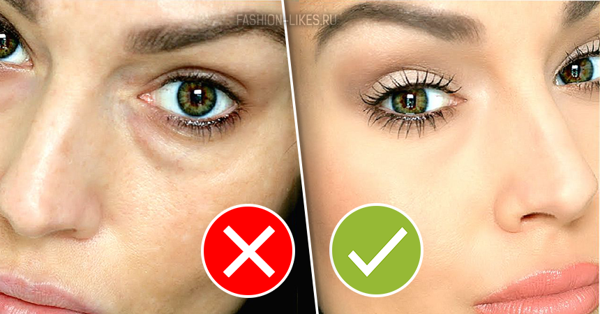 Не рано ли: как ухаживать за молодой кожей вокруг глаз