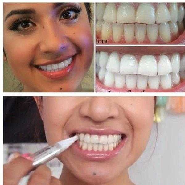 посоветуйте отбеливание зубов