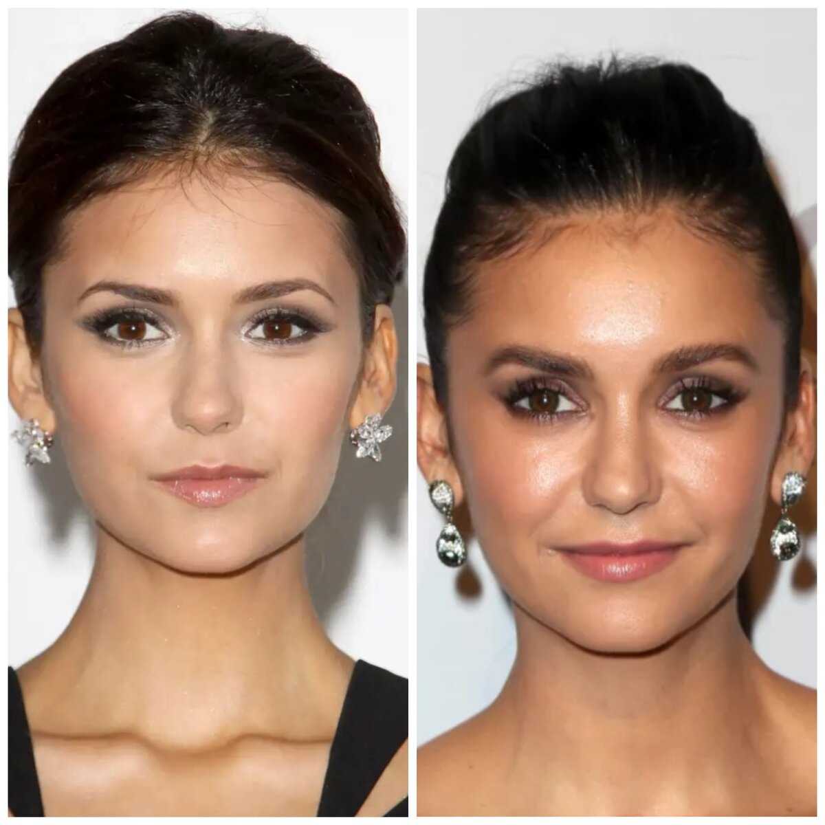 Nina dobrev nose job