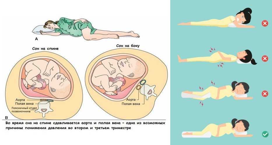 Можно ли наращивать ресницы во время беременности: все за и против