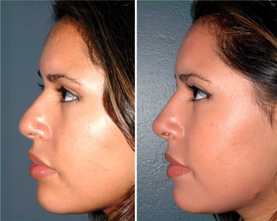 Контуринг носа: как выполнить правильно. пошаговая инструкция
