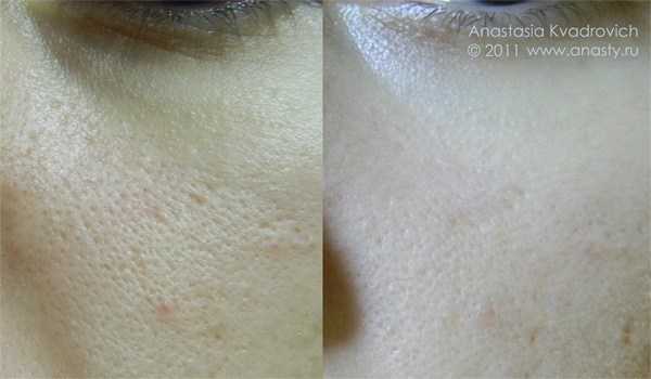 Крем, сужающий поры на лице, средство, не забивающее поры, косметика для жирной кожи с расширенными порами