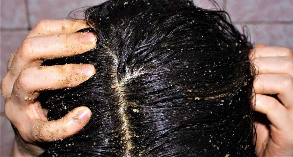 Удаление загрязнений с шампунем глубокой очистки волос