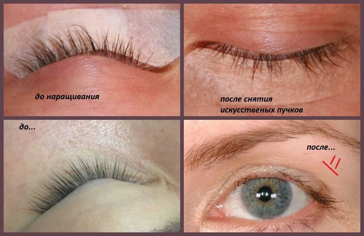 Как сохранить красоту после химиотерапии • русский доктор
