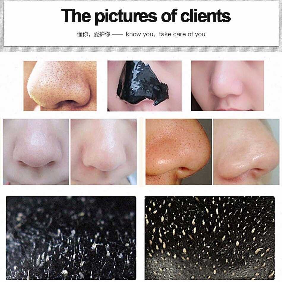 Маска для лица с активированным углем: очищающая от черных точек на носу, угольная от прыщей в домашних условиях