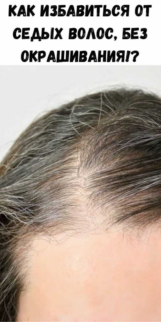 Лазерное удаление волос – реально ли навсегда?