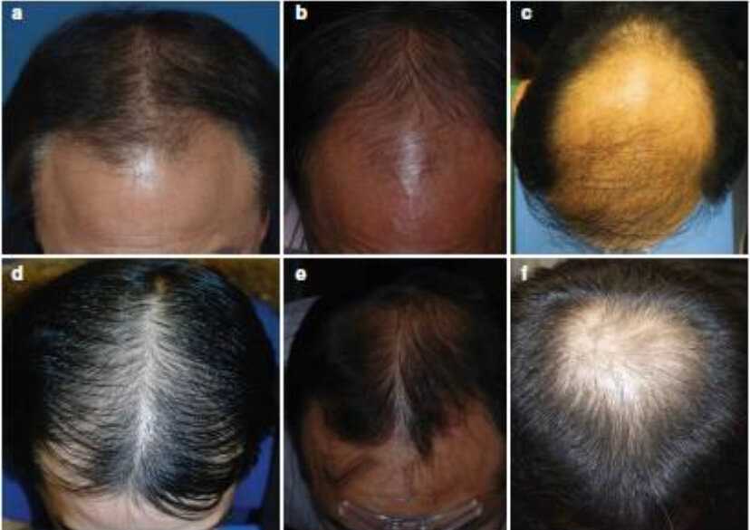 Топ-5 процедур для волос