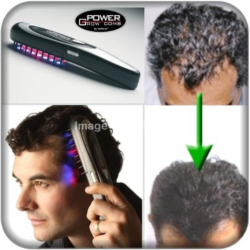 Лазерная расческа от выпадения волос: отзывы врачей и пользователей