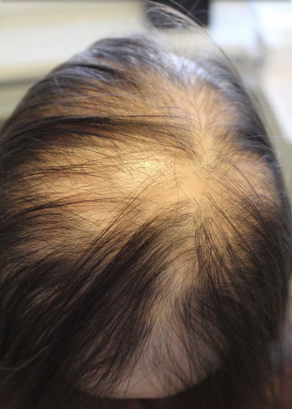 Укрепление корней волос