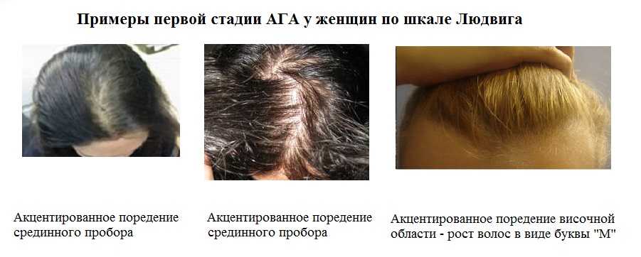 Маски для роста волос с витаминами в домашних условия - b1, b3, b6, b10, b12, a, e, c в ампулах