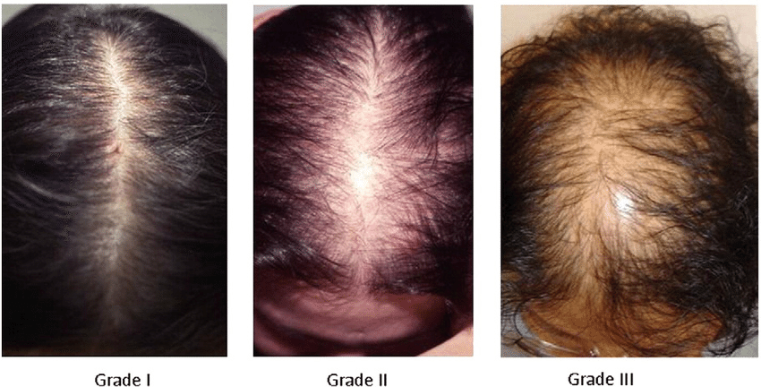 Как укрепить волосы от выпадения в домашних условиях и в салоне – обзор 9 средств и 3 процедур