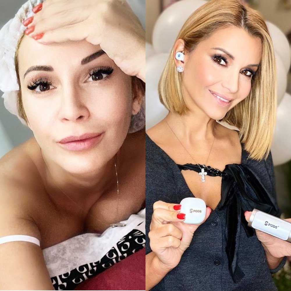 Дженнифер лоуренс до и после пластики: фото - 300 экспертов.ру