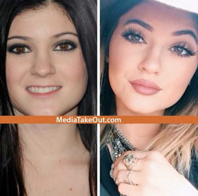 Кайли дженнер: помада, инстаграм, макияж, фото до и после пластики