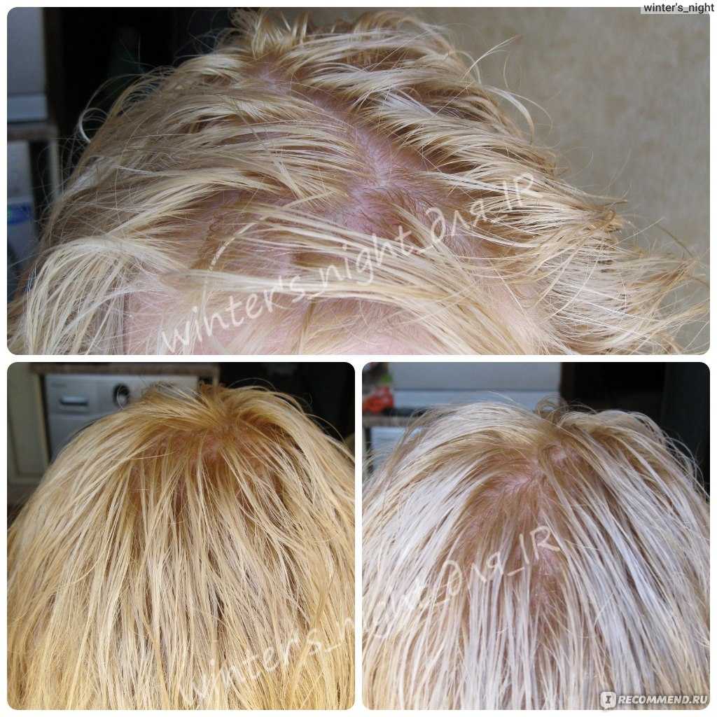 Волосы после утюжка - как восстановить сожженные волосы после утюжка