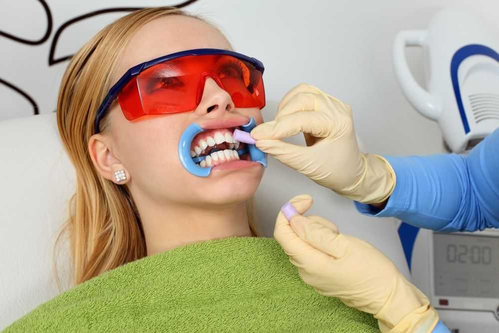 отбеливание зубов у стоматолога видео