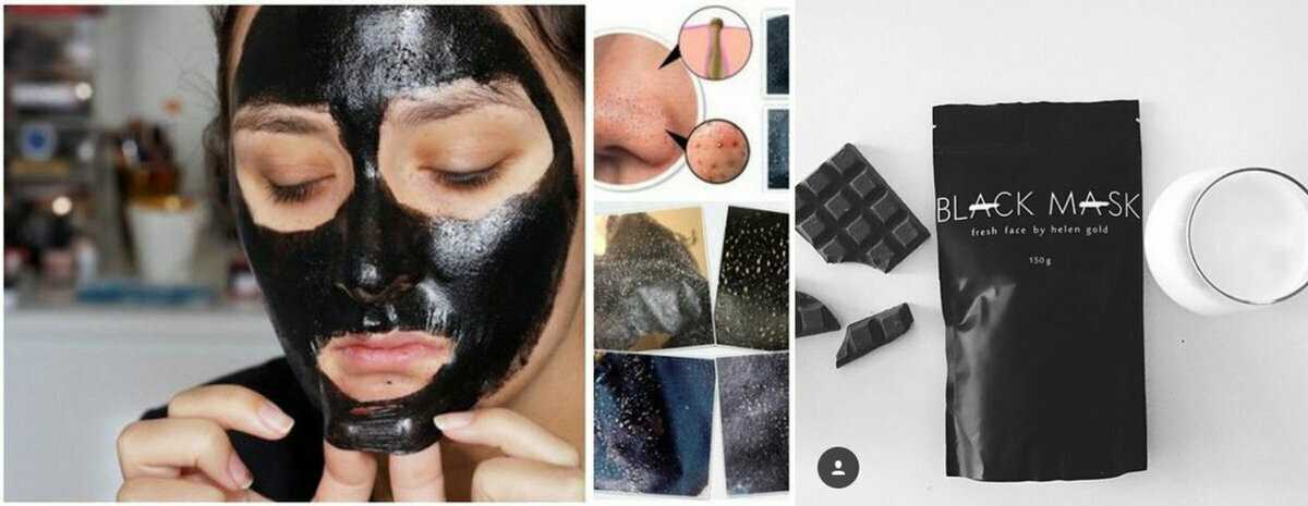 Черная маска от черных точек. очищающая черная маска с активированным углем от прыщей и черных точек в домашних условиях: лучшие рецепты