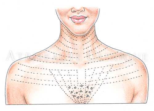 Что нужно знать об уколах ботокса в область лица и шеи